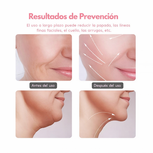LÚMINA LIFT - Masajeador Facial Reafirmante